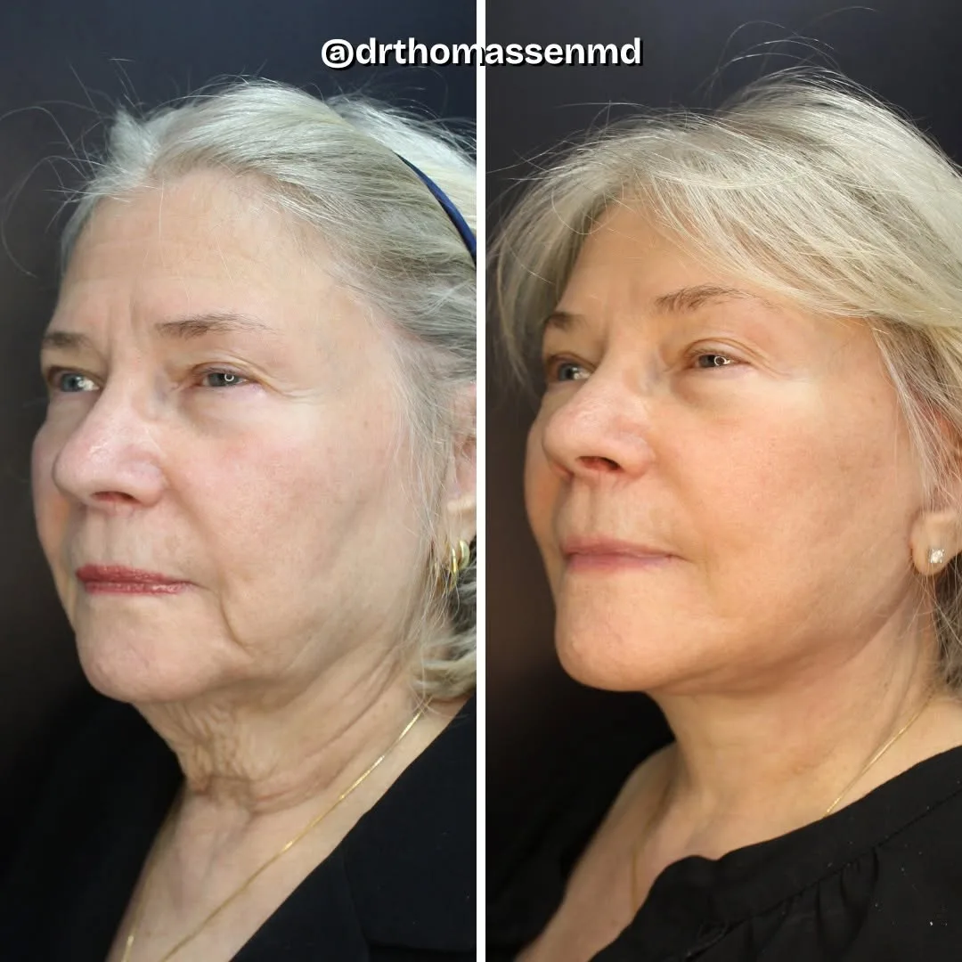 Before and after: Dr. John Michael Thomassen