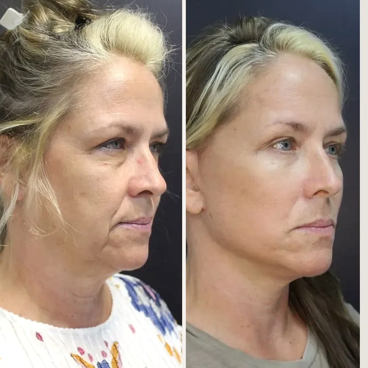 Before and after: Dr. John Michael Thomassen