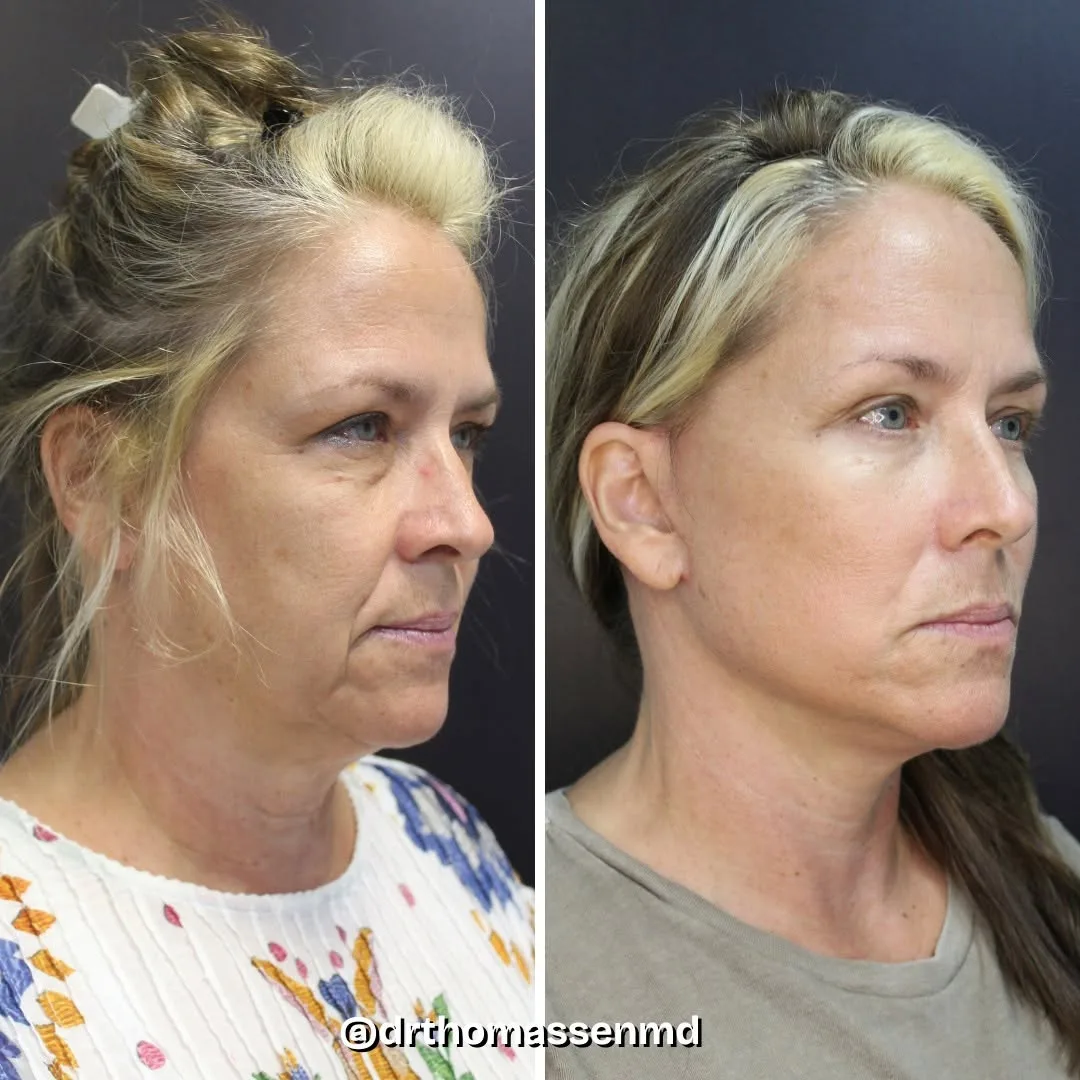 Before and after: Dr. John Michael Thomassen