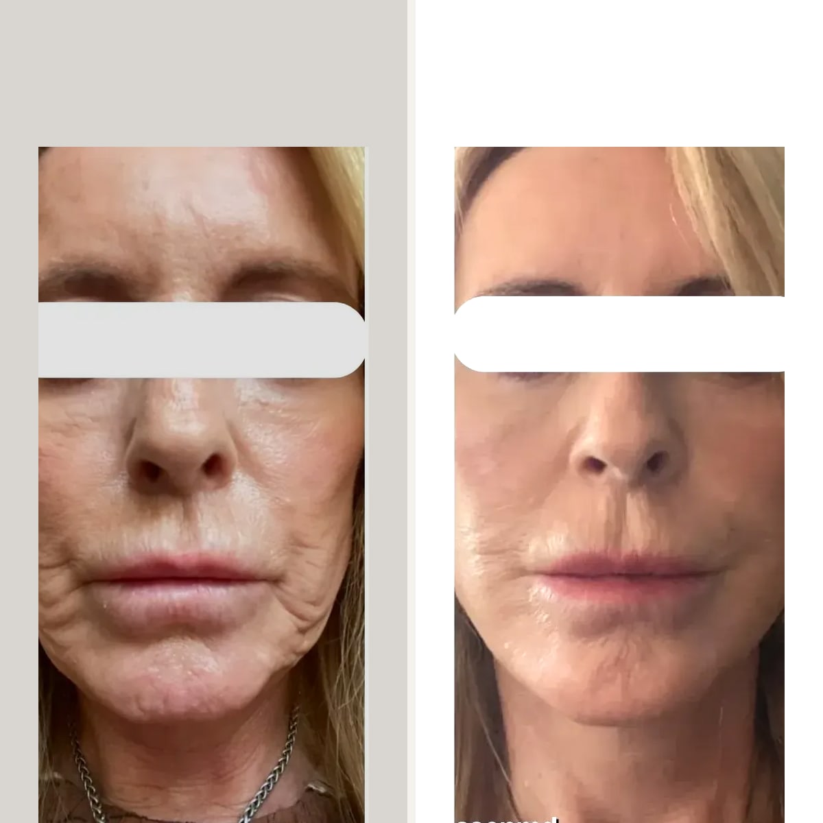 Before and after: Dr. John Michael Thomassen