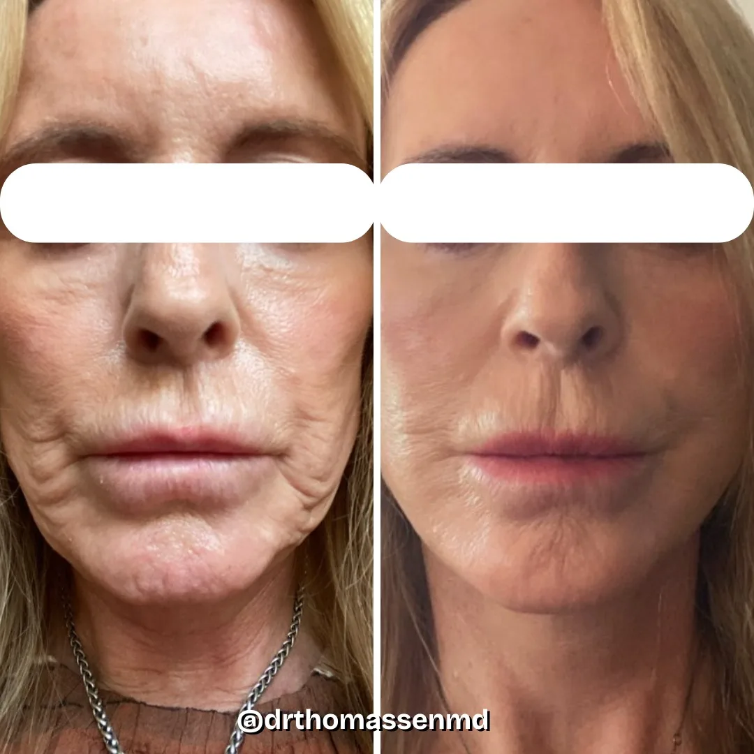 Before and after: Dr. John Michael Thomassen