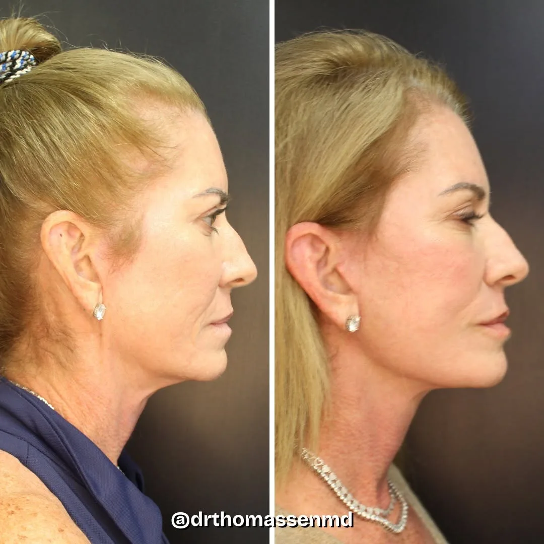 Before and after: Dr. John Michael Thomassen