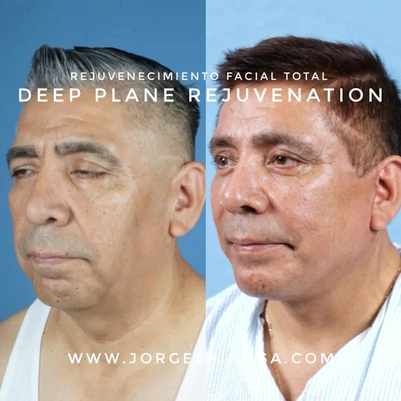 Before and after: Dr. Jorge Espinosa