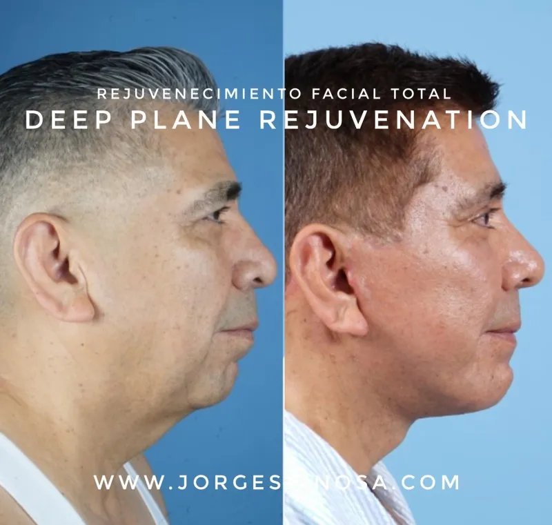 Before and after: Dr. Jorge Espinosa