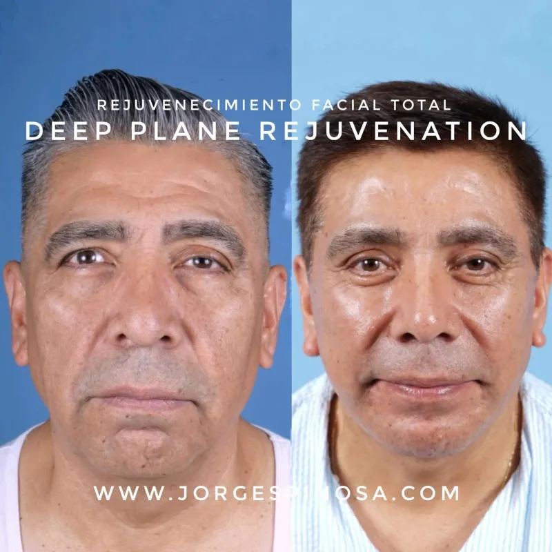 Before and after: Dr. Jorge Espinosa