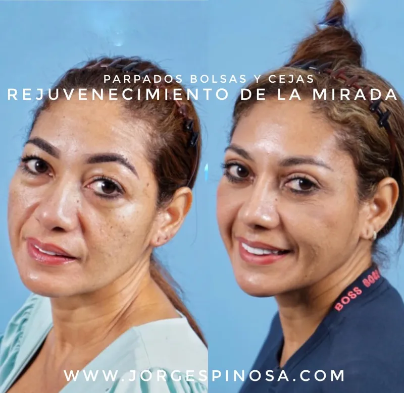 Before and after: Dr. Jorge Espinosa
