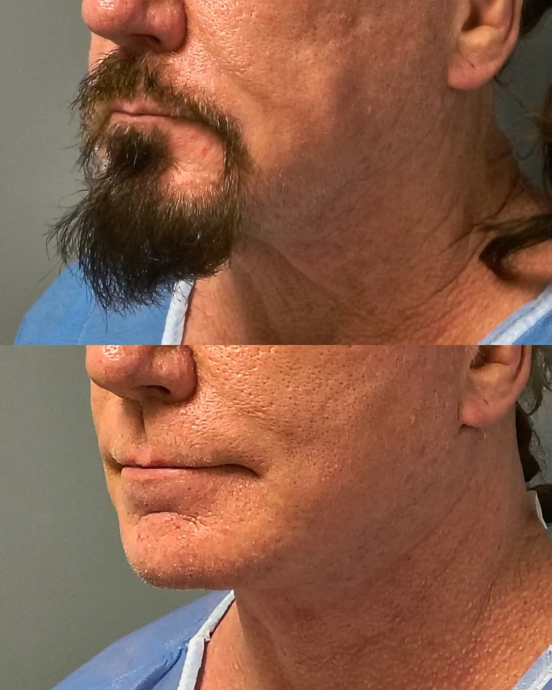 Before and after — Dr. Jorge Mario Rodriguez