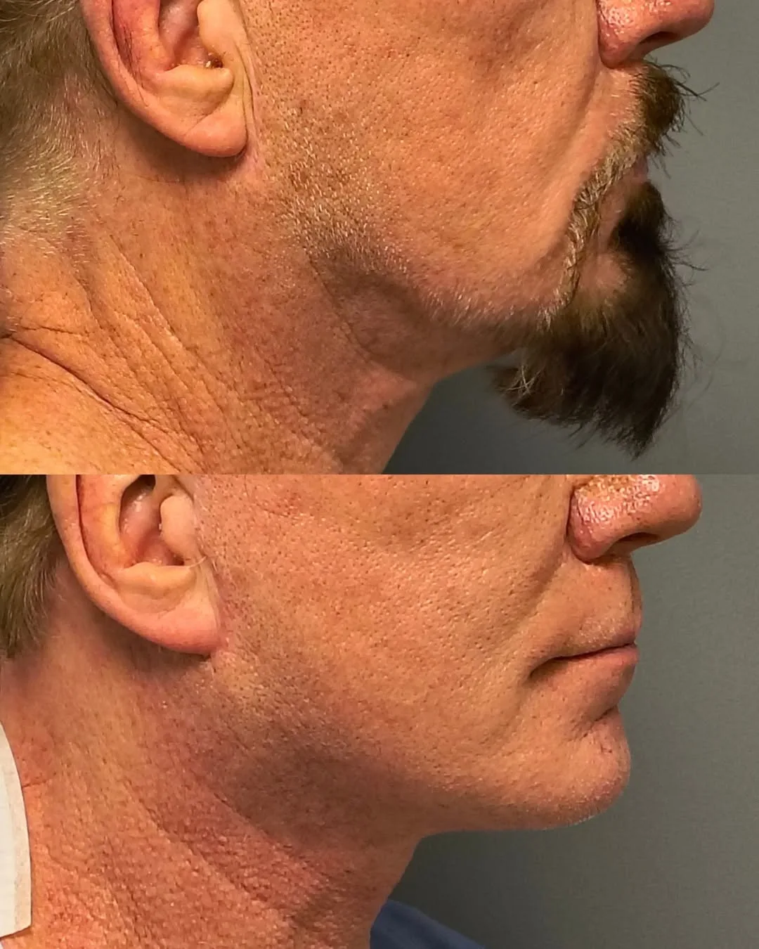 Before and after — Dr. Jorge Mario Rodriguez