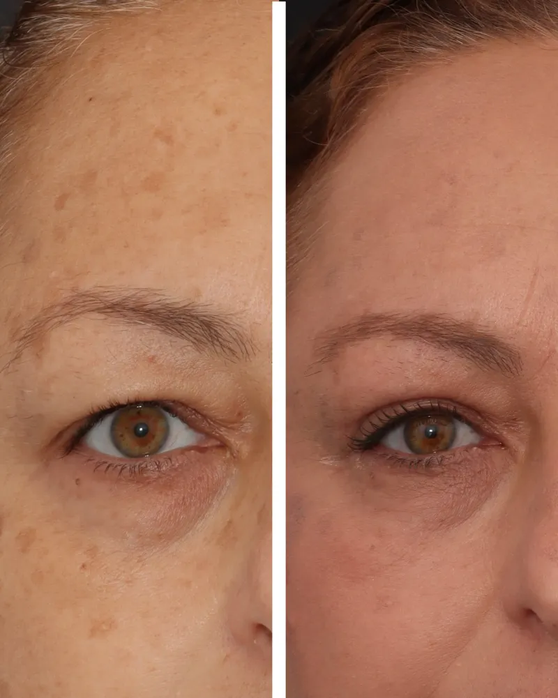 Before and after — Dr. Jose Antonio Martínez Fernández