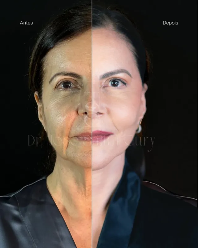 Before and after — Dr. José Cury