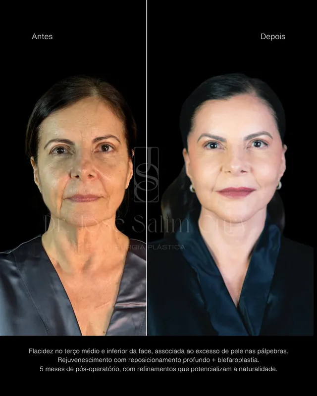 Before and after — Dr. José Cury