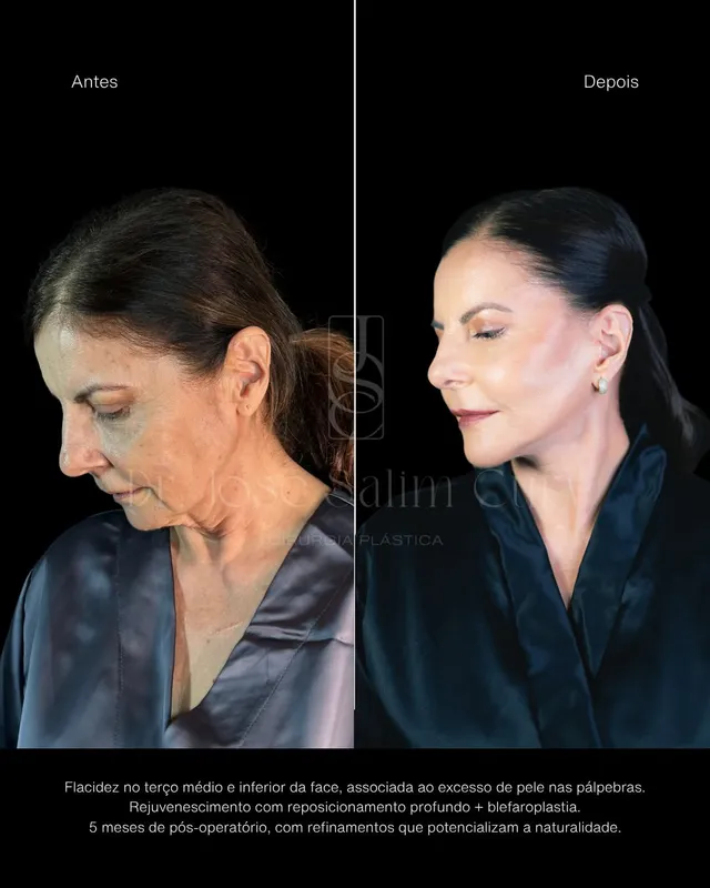 Before and after — Dr. José Cury