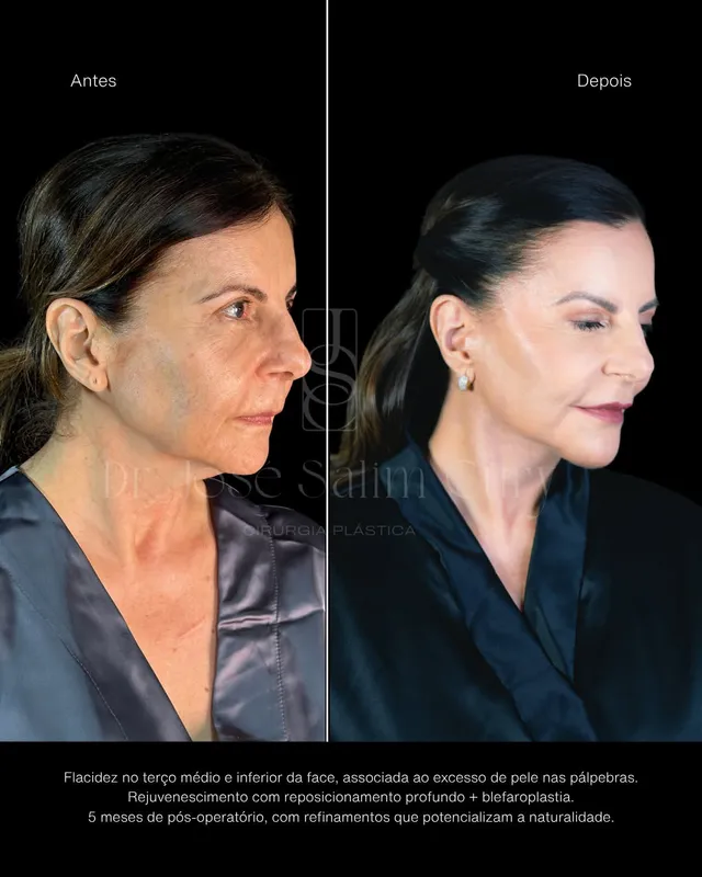 Before and after — Dr. José Cury
