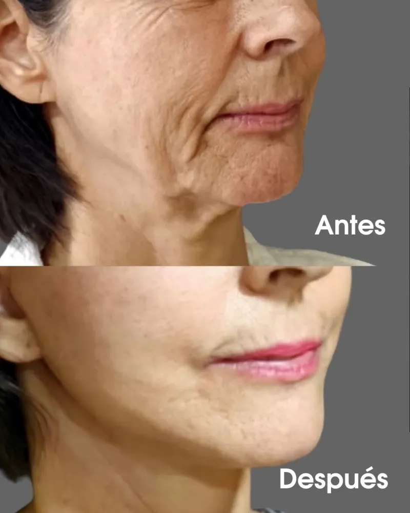 Before and after: Dr. José Lasen