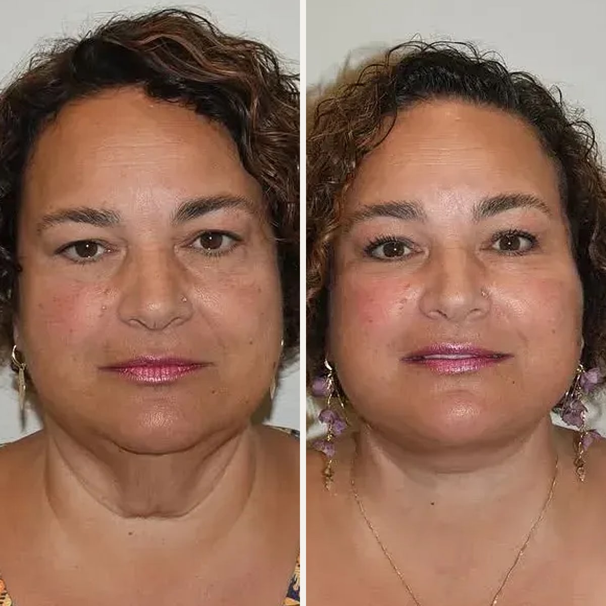 Before and after: Dr. Joseph Russell