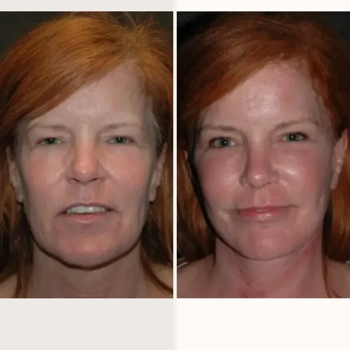 Before and after: Dr. Joseph Russell