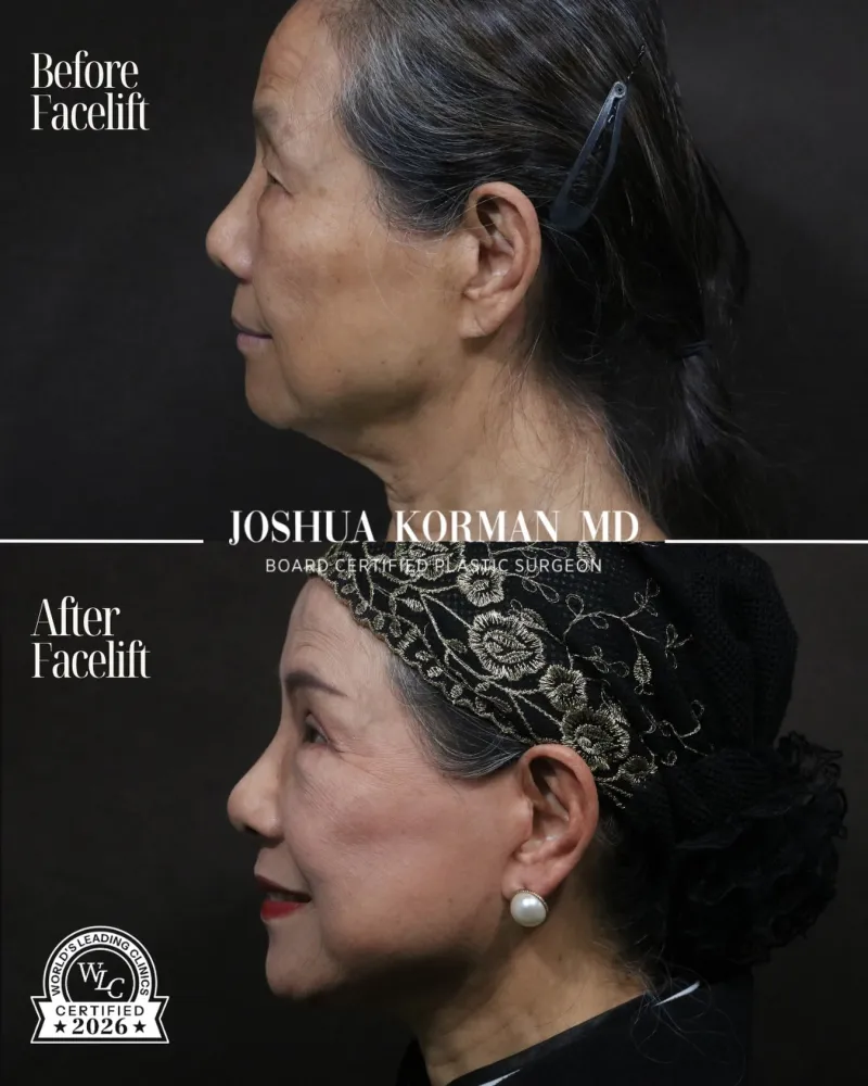 Before and after — Dr. Josh Korman