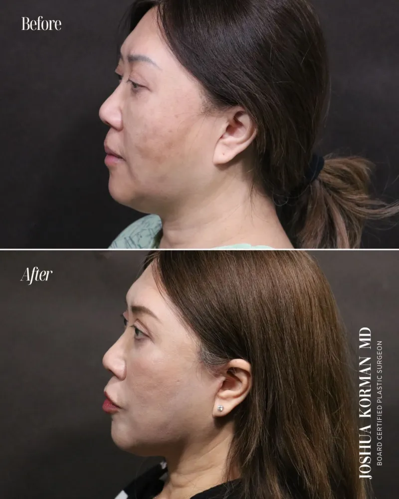 Before and after — Dr. Josh Korman