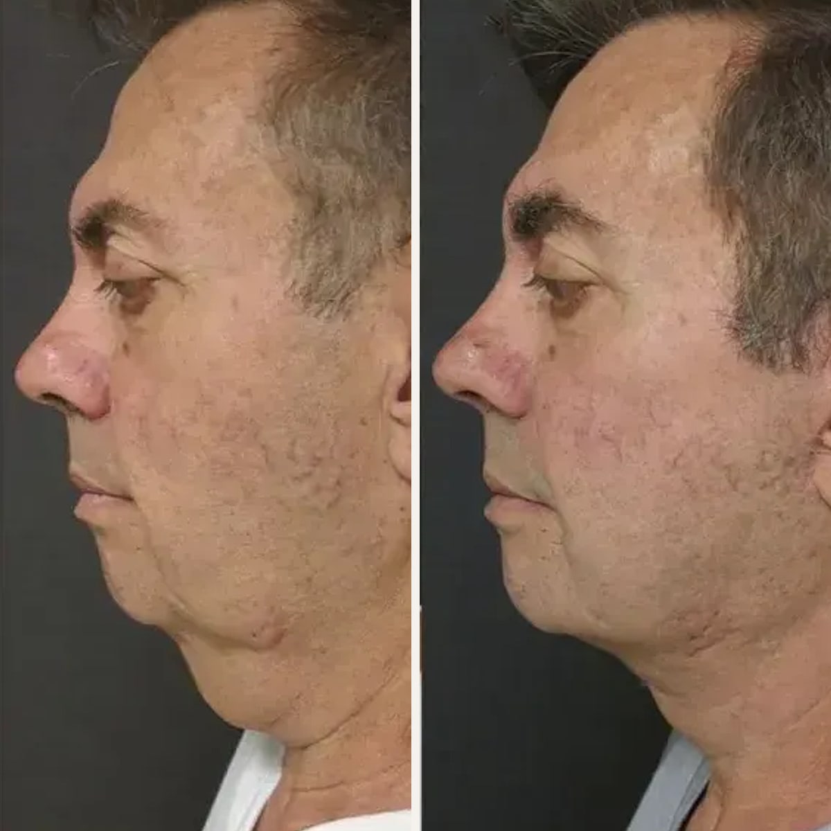 Before and after: Dr. Joshua Lampert