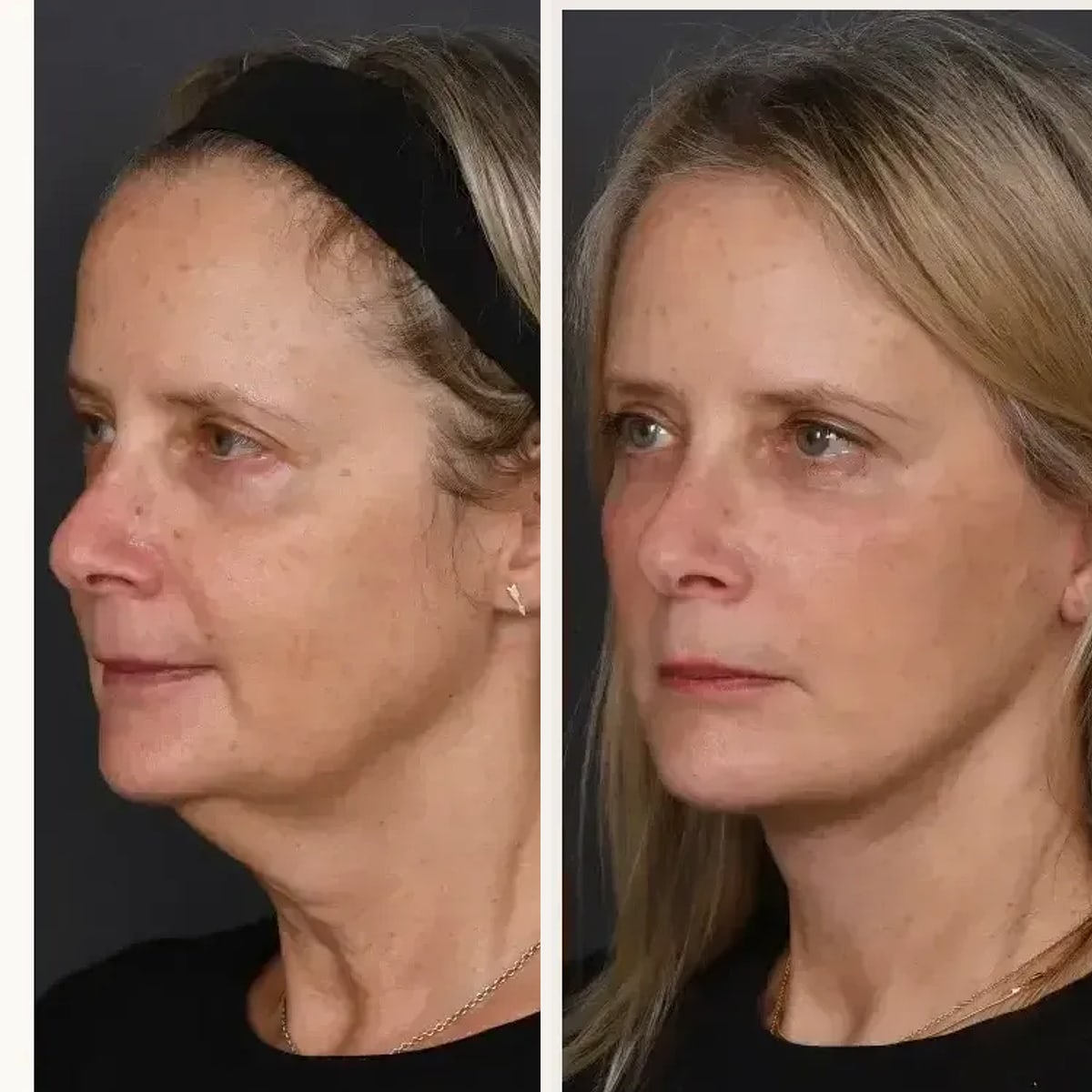 Before and after: Dr. Joshua Zimm