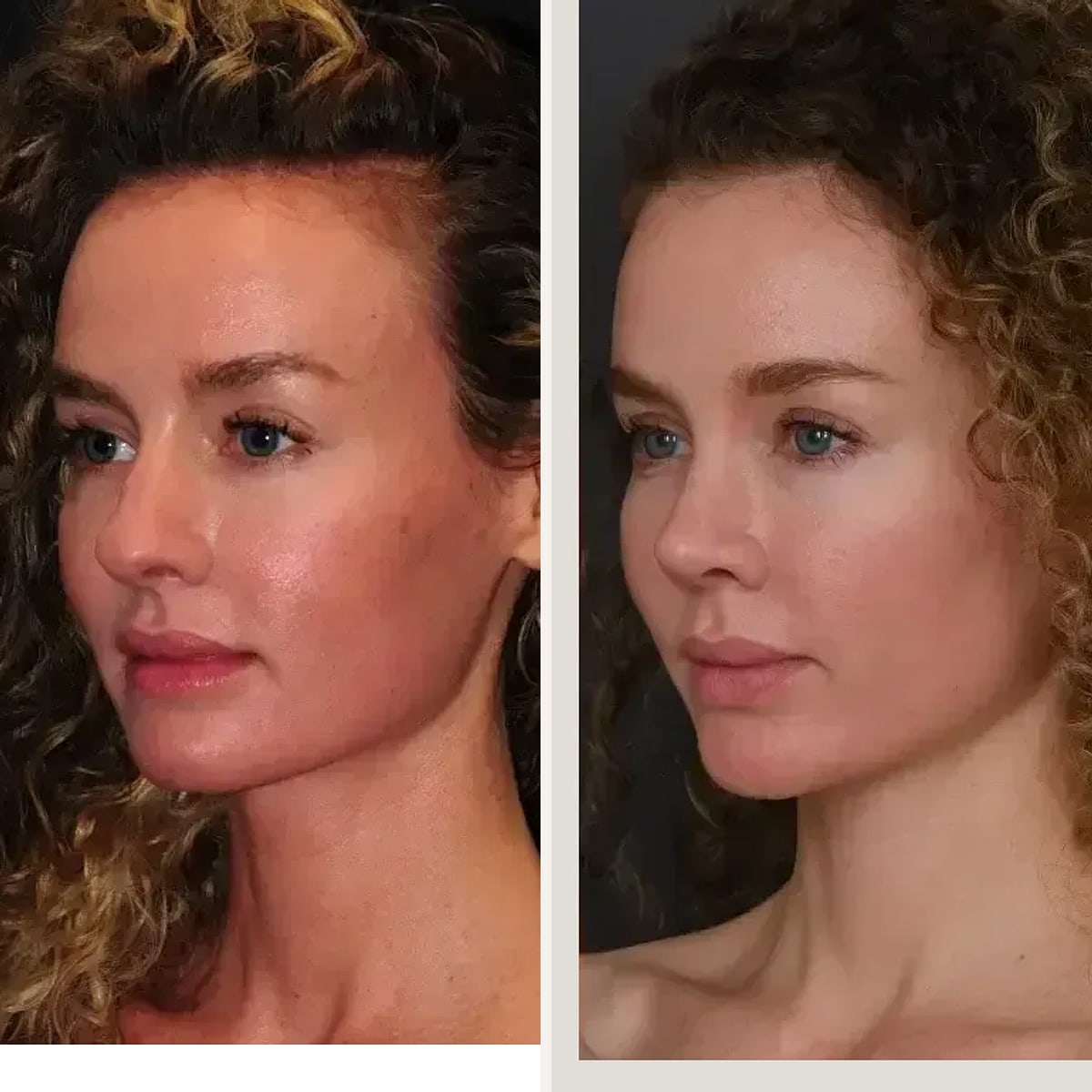 Before and after: Dr. Joshua Zimm
