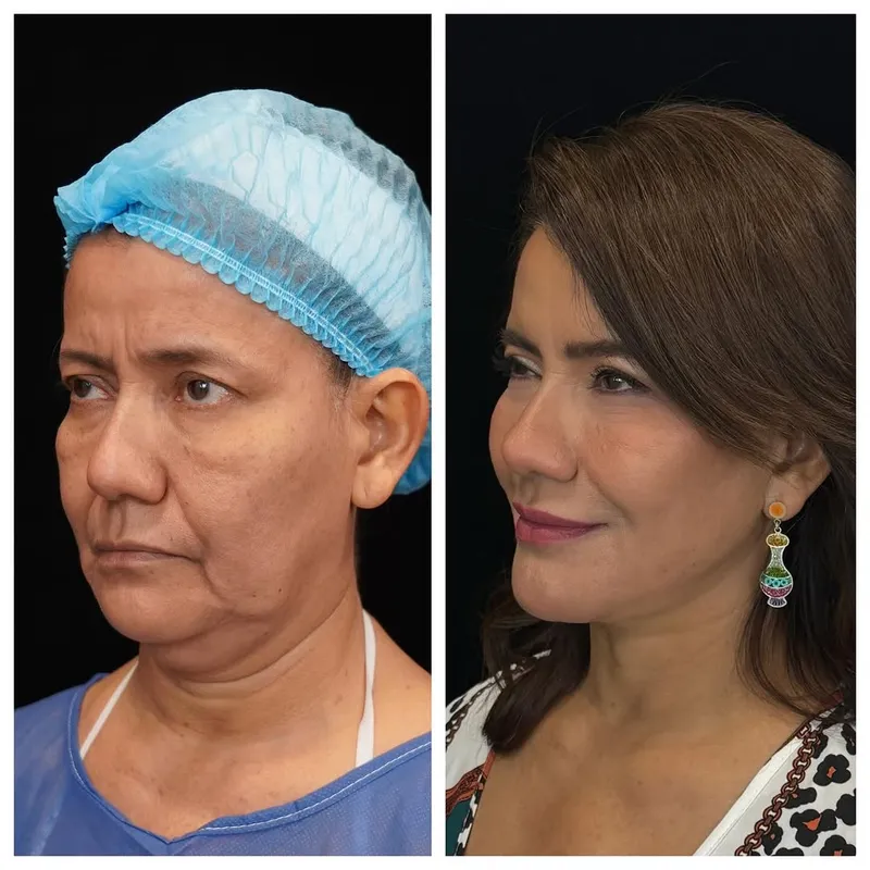 Before and after — Dr. JP Menendez