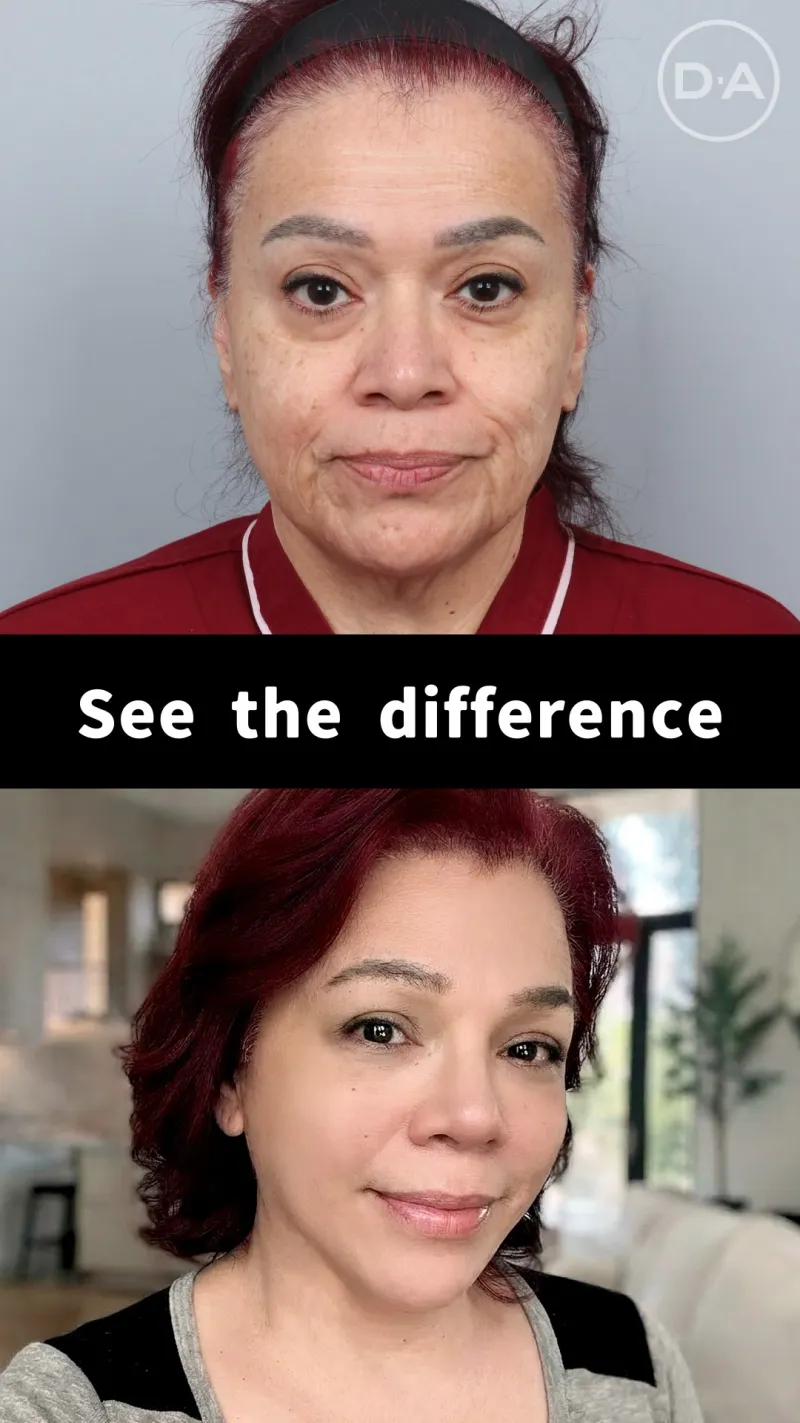 Before and after: Dr. Ju Yong Kwon