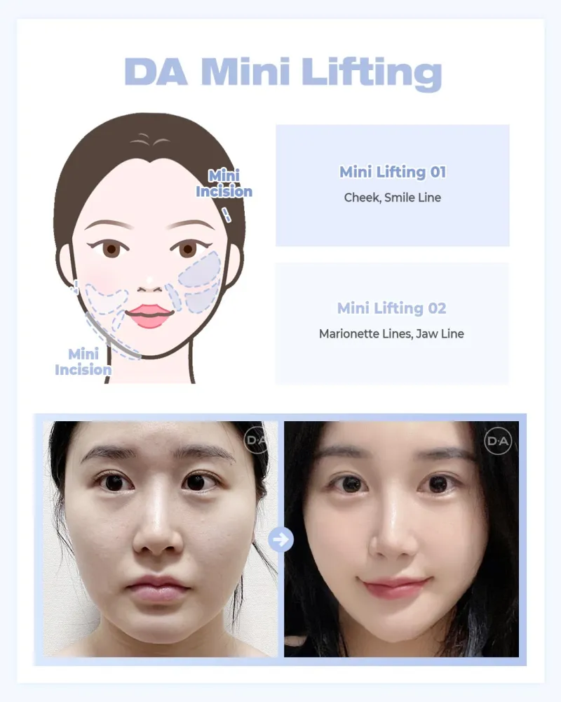 Before and after: Dr. Ju Yong Kwon