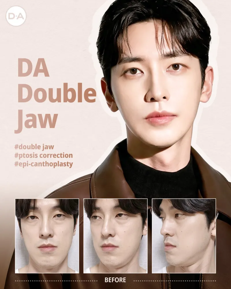 Before and after: Dr. Ju Yong Kwon