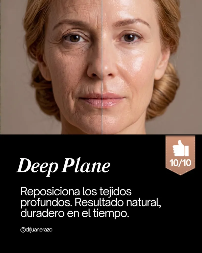 Before and after: Dr. Juan Guillermo Erazo