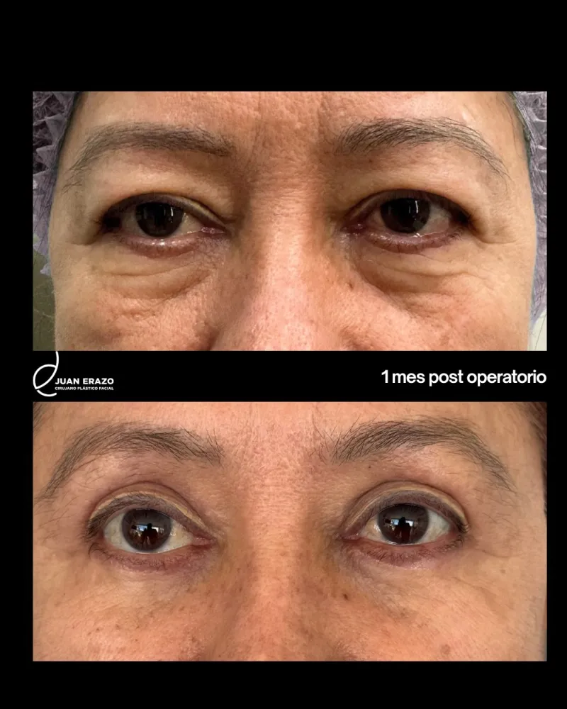 Before and after: Dr. Juan Guillermo Erazo