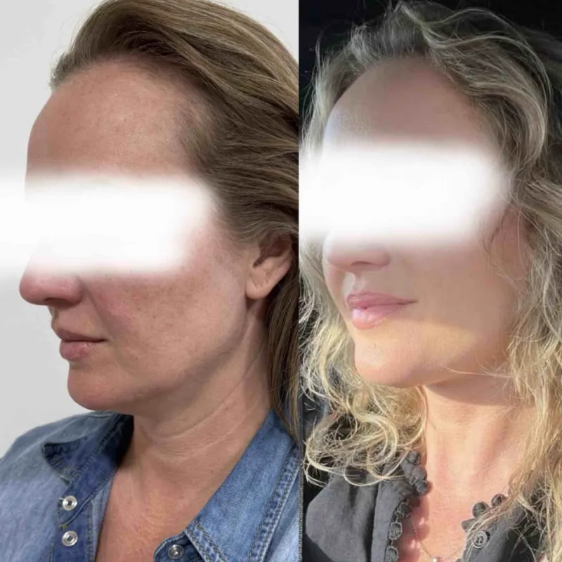 Before and after — Dr. Juraj Gajdoš