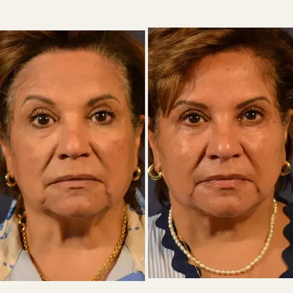 Before and after: Dr. Kailash Narasimhan