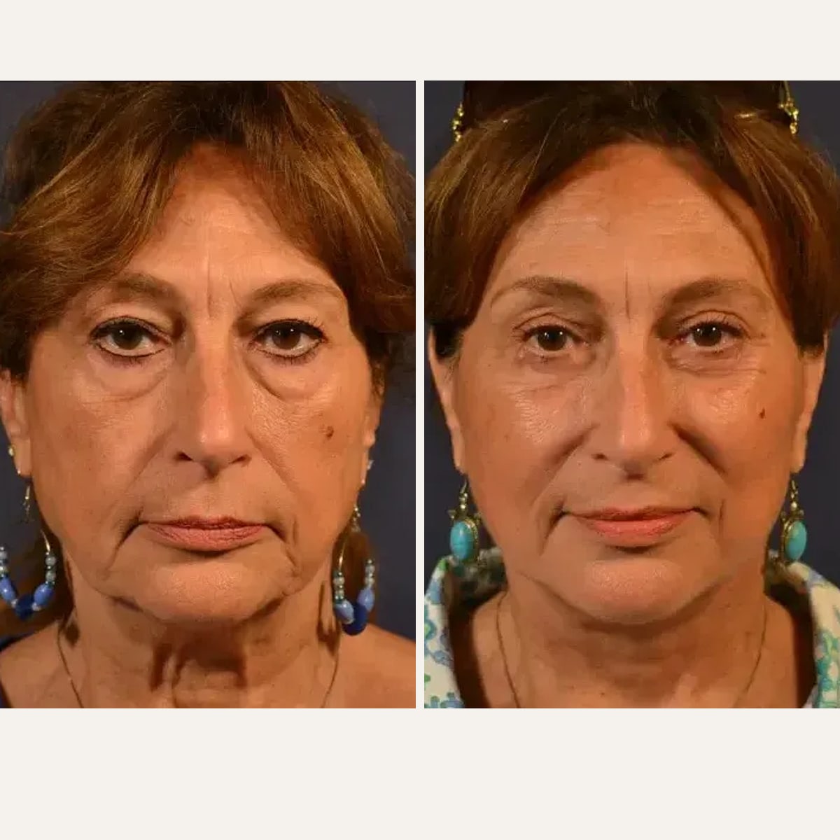 Before and after: Dr. Kailash Narasimhan
