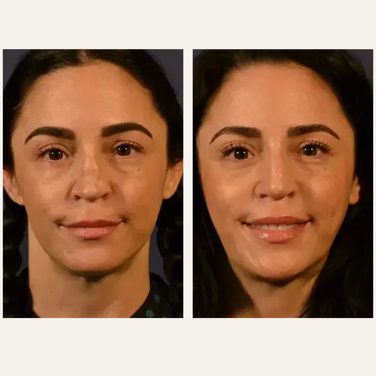 Before and after: Dr. Kailash Narasimhan