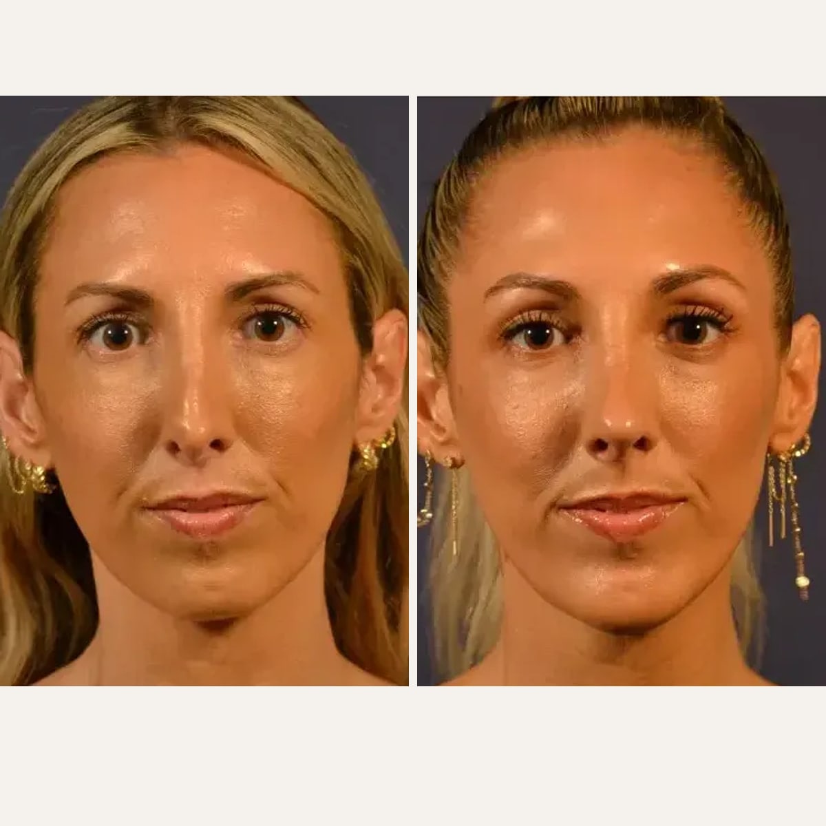 Before and after: Dr. Kailash Narasimhan
