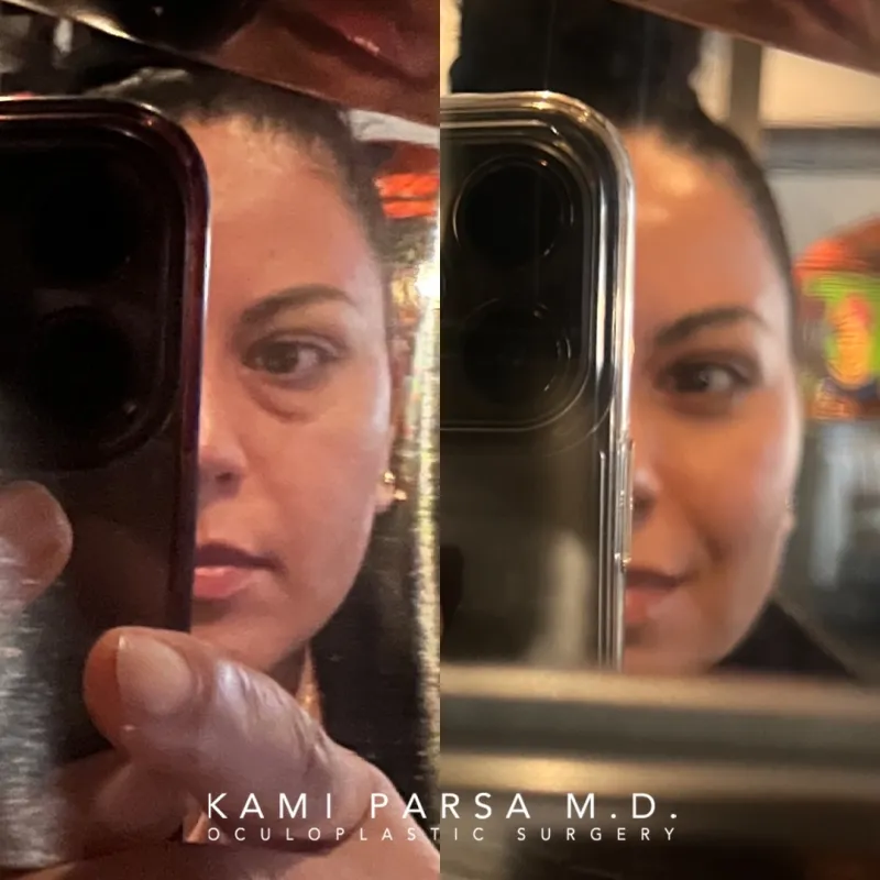 Before and after: Dr. Kami Parsa