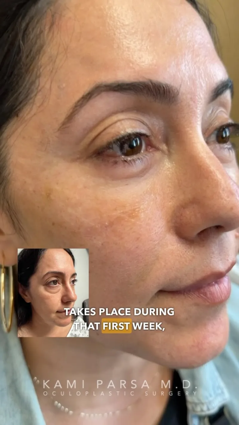 Before and after — Dr. Kami Parsa
