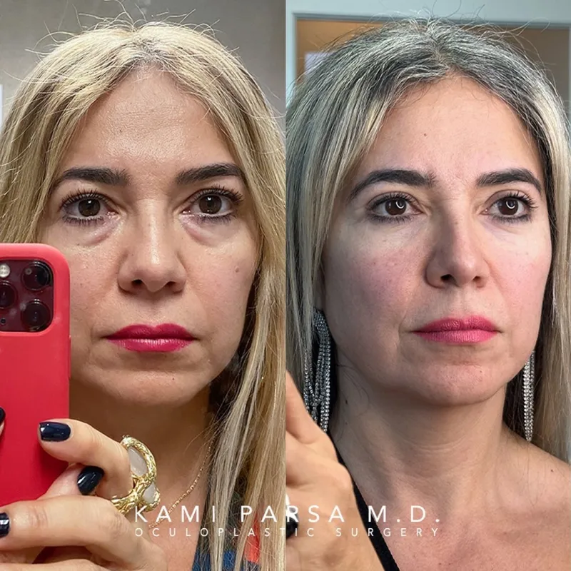 Before and after — Dr. Kami Parsa