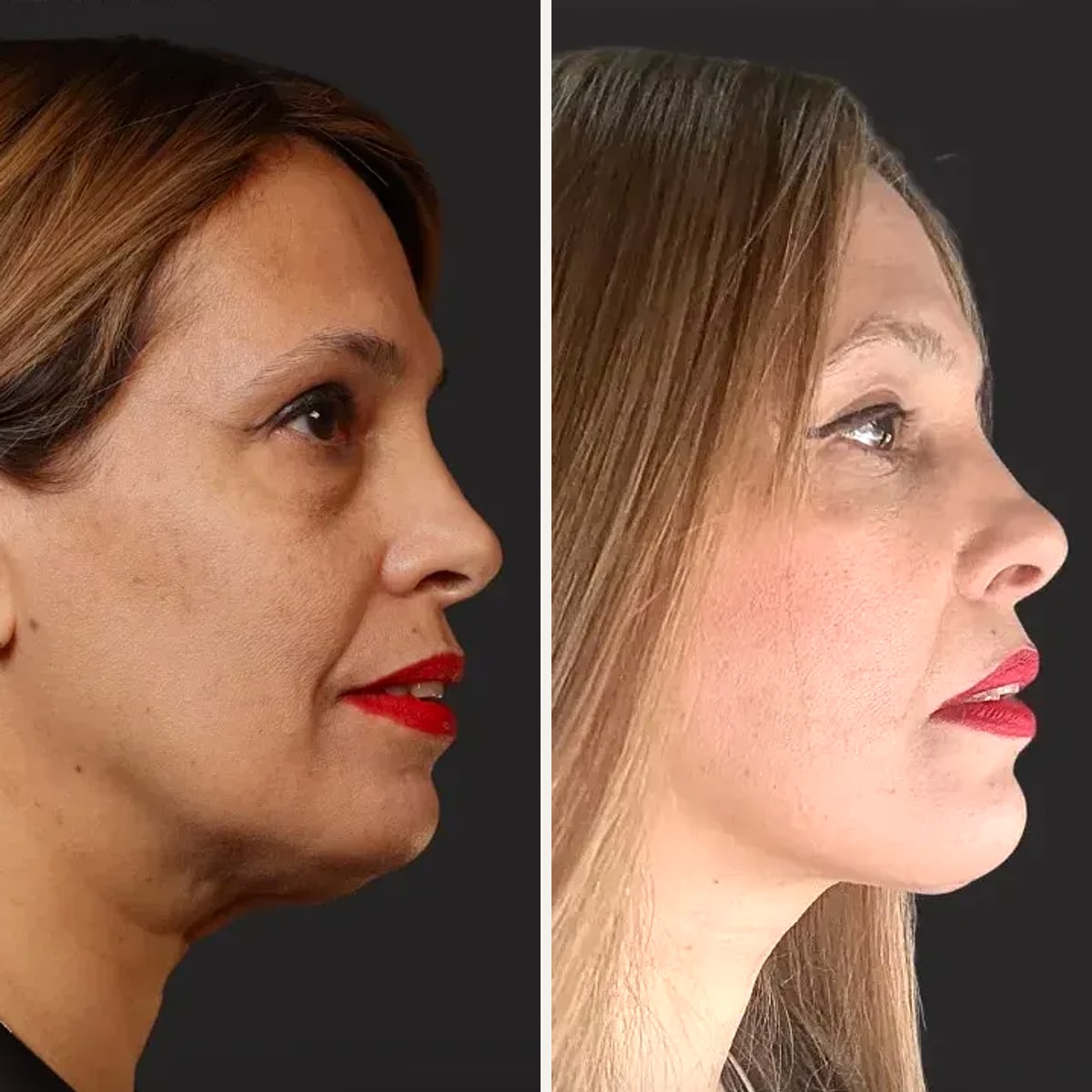 Before and after: Dr. Karan Chopra