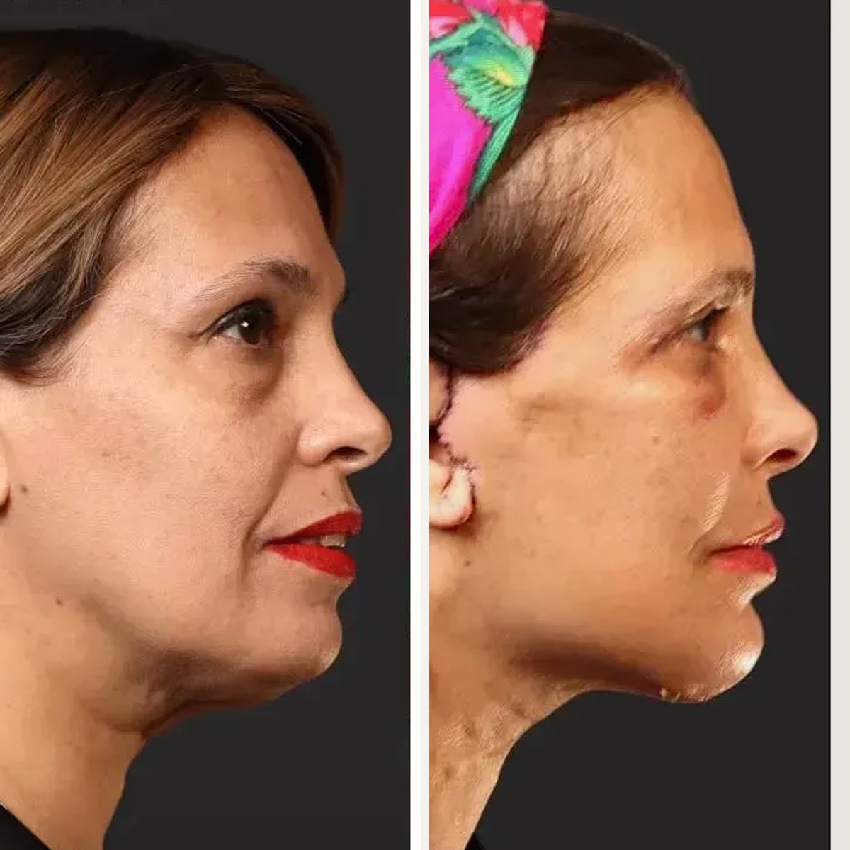 Before and after: Dr. Karan Chopra