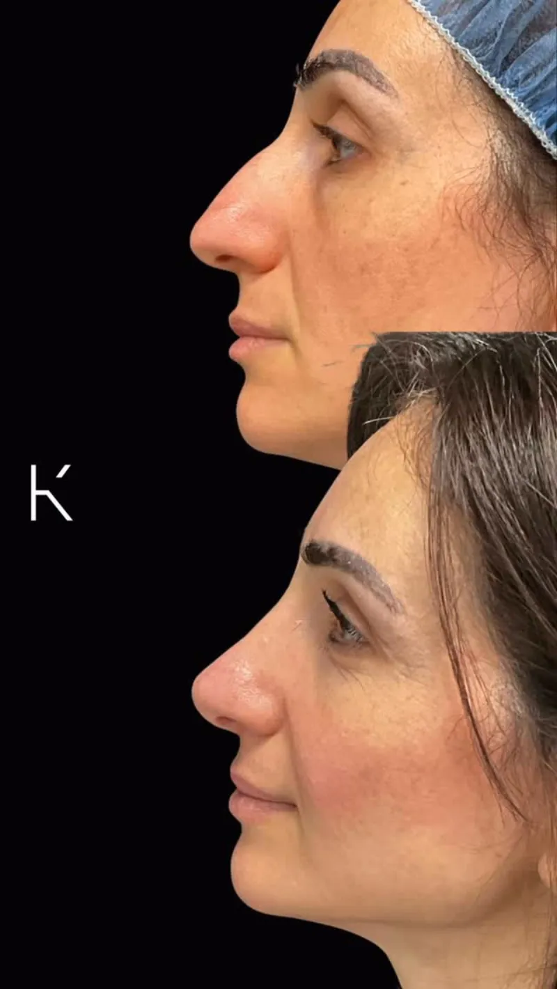 Before and after — Dr. Karl Schwarz