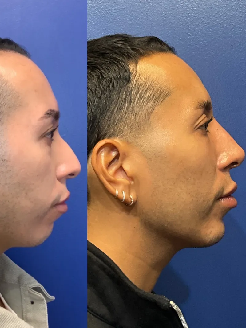 Before and after — Dr. Kay Durairaj