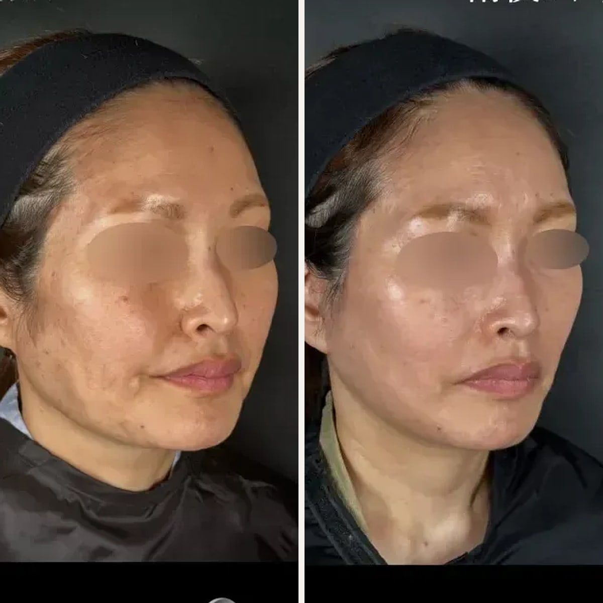 Before and after: Dr. Kenji Kuwazuru