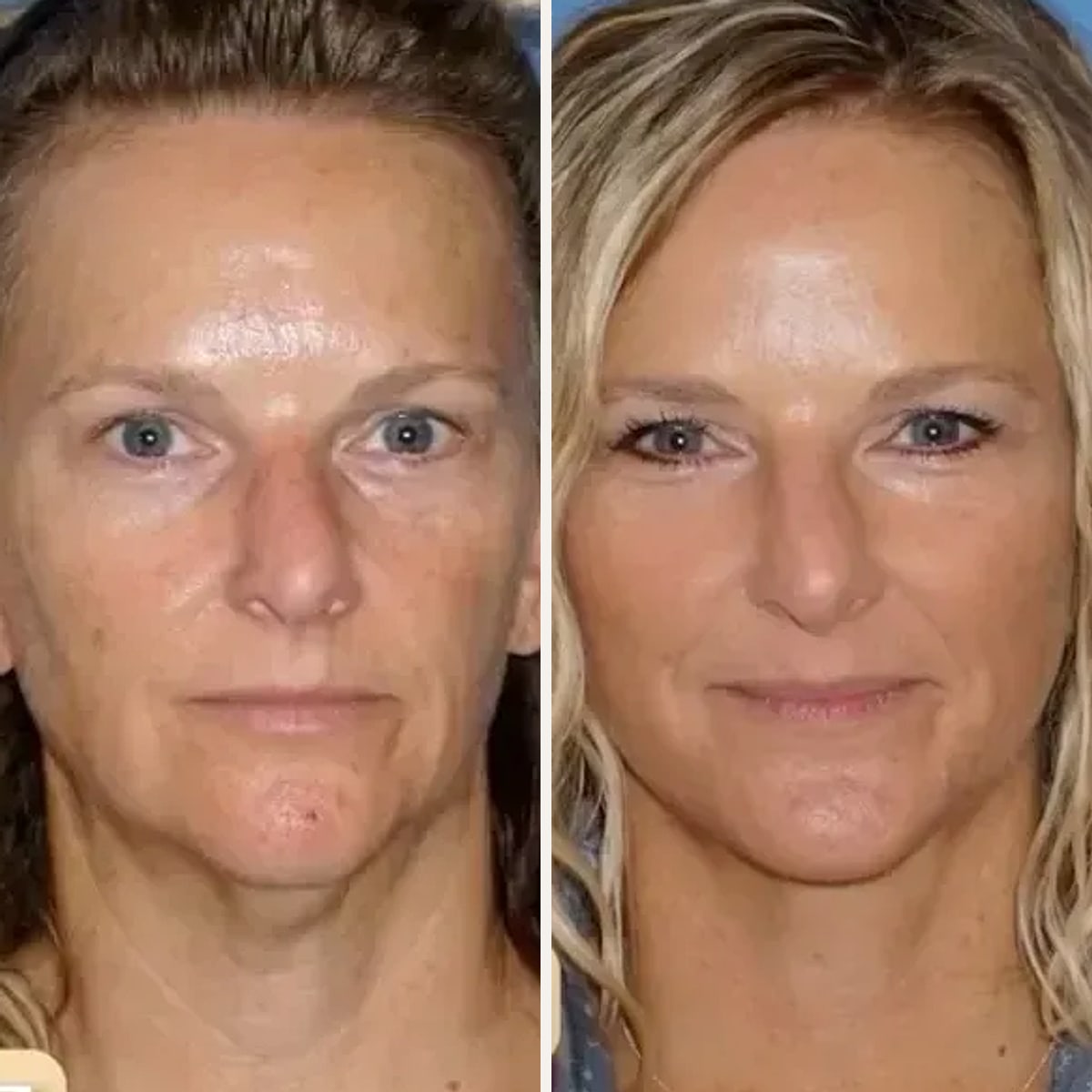 Before and after: Dr. Kevin Sadati