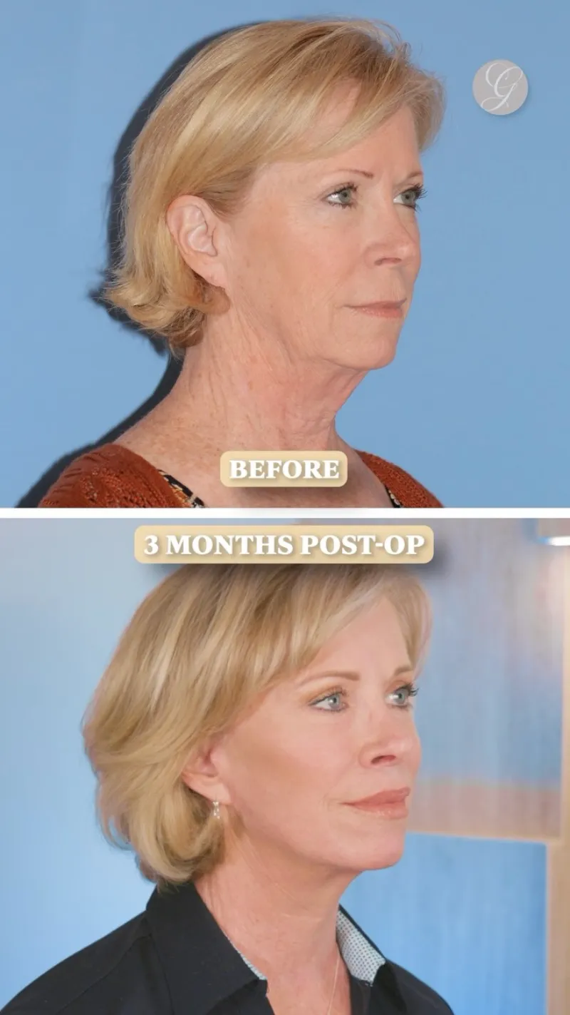 Before and after: Dr. Kevin Sadati