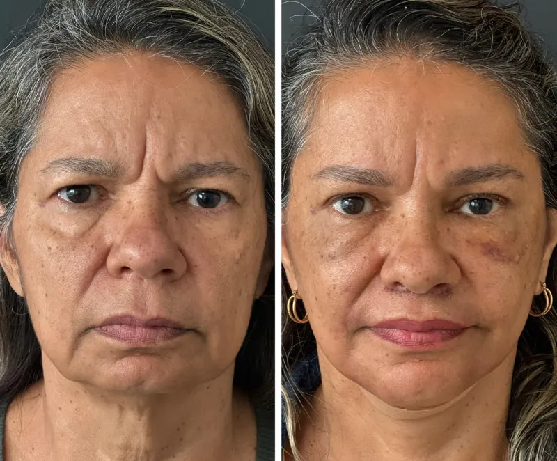 Before and after: Dr. Klaus Rodrigues de Oliveira