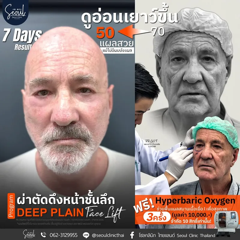 Before and after — Dr. Korravee Tangekachai