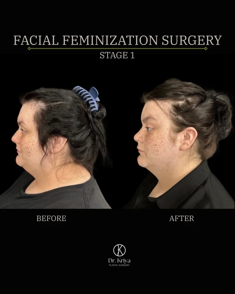 Before and after: Dr. Kriya Gishen