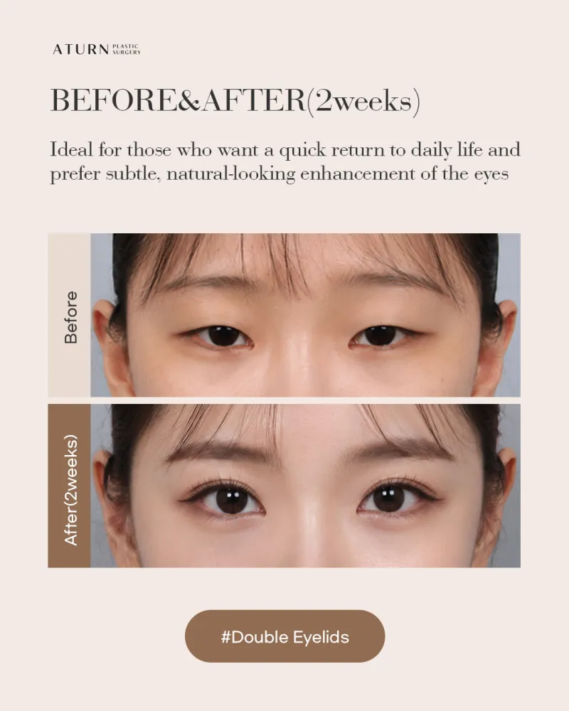 Before and after: Dr. Kyung-chan Ahn